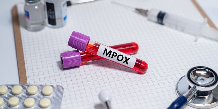 Για επιδημία mpox στην Ευρώπη φοβάται ο ΠΟΥ